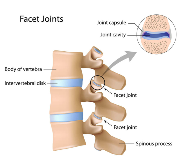 Facet Joint - Facet Joint Pain Treatment