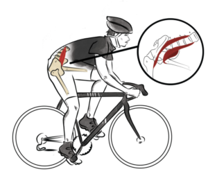 Pain-Free Ride. Find Out How! - Active Lifestyle & Gym Soreness pain-free ride