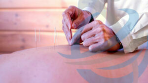 Dry Needling and Osteopathy