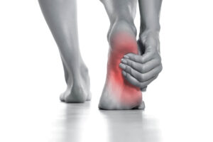 Plantar Fasciitis