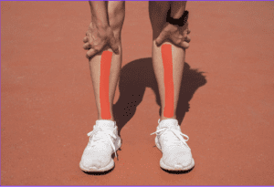 Shin Splints