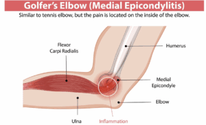 Screenshot 2025 07 31 at 2.06.28 pm Equilibrium Sports and Spinal Clinic